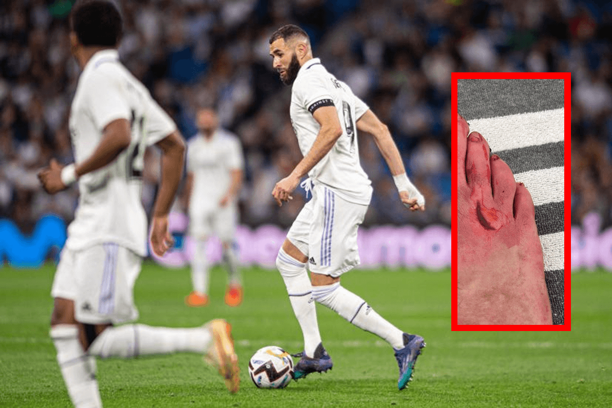 ️⚽️ Karim Benzema joue avec une entaille au pied et marque contre Rayo Vallecano 1 ️⚽️ Karim Benzema joue avec une entaille au pied et marque contre Rayo Vallecano