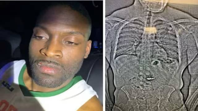 🇺🇲 Un voleur avale des bijoux en diamant à 770 000 $ pour tenter d’échapper à la police