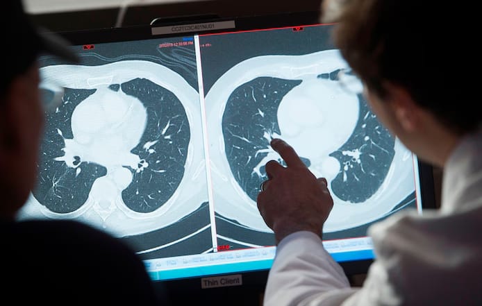 🌍 Hausse inquiétante des cancers chez les jeunes adultes : les scientifiques s’interrogent 1 🌍 Hausse inquiétante des cancers chez les jeunes adultes : les scientifiques s’interrogent
